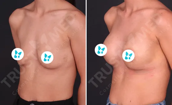 Before After Trustmed