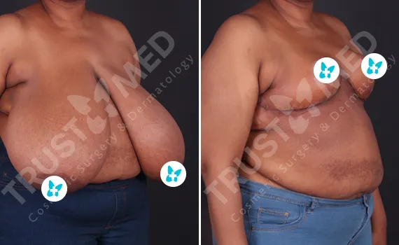 Before After Trustmed