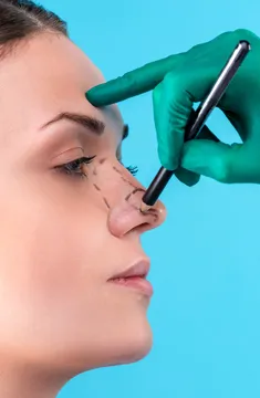 Rhinoplasty with Rib Cartilage