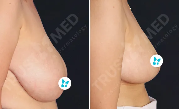 Before After Trustmed