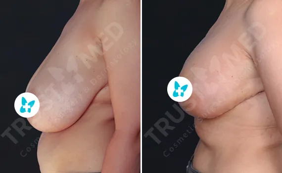 Before After Trustmed