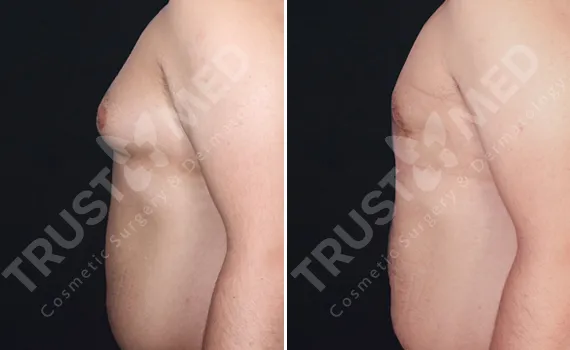 Before After Trustmed