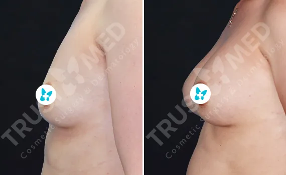 Before After Trustmed