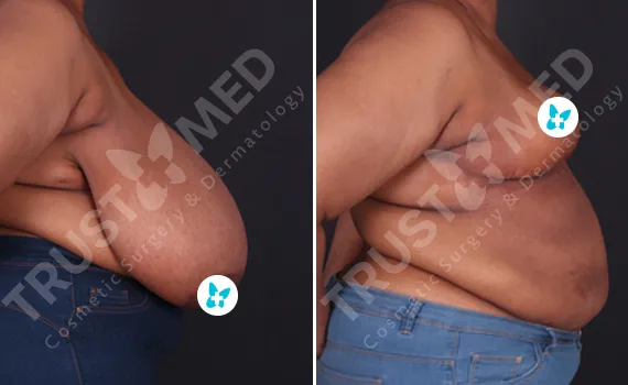 Before After Trustmed