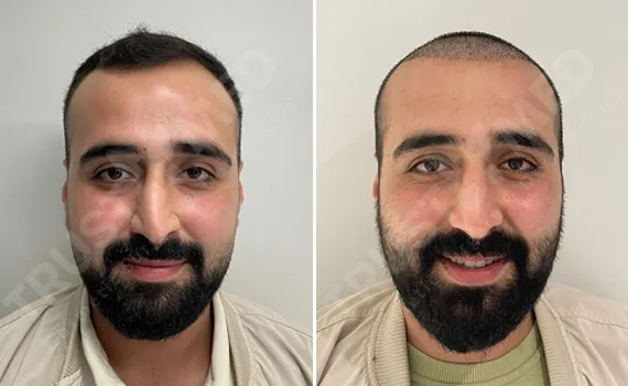 Before After Trustmed