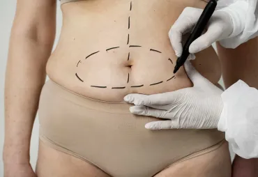 Best Plastic Surgery Procedures in Turkey: A Comprehensive List