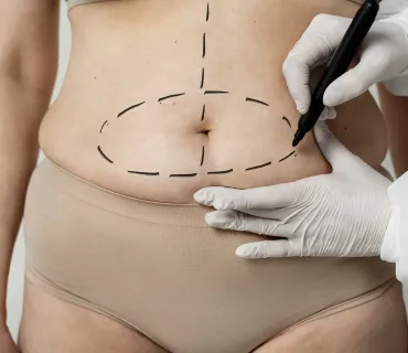 Best Plastic Surgery Procedures in Turkey: A Comprehensive List