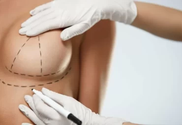 Beyond Expectations: The Science of Breast Lift Surgery in Turkey