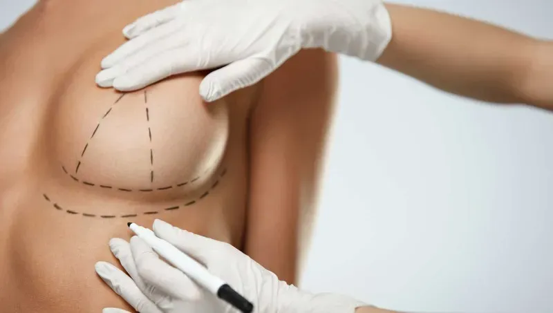 Beyond Expectations: The Science of Breast Lift Surgery in Turkey