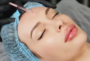 Beyond Wrinkles: Botox Injections as a Treatment for Migraines