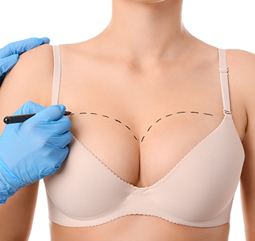 Breast Augmentation - TrustMed Clinic