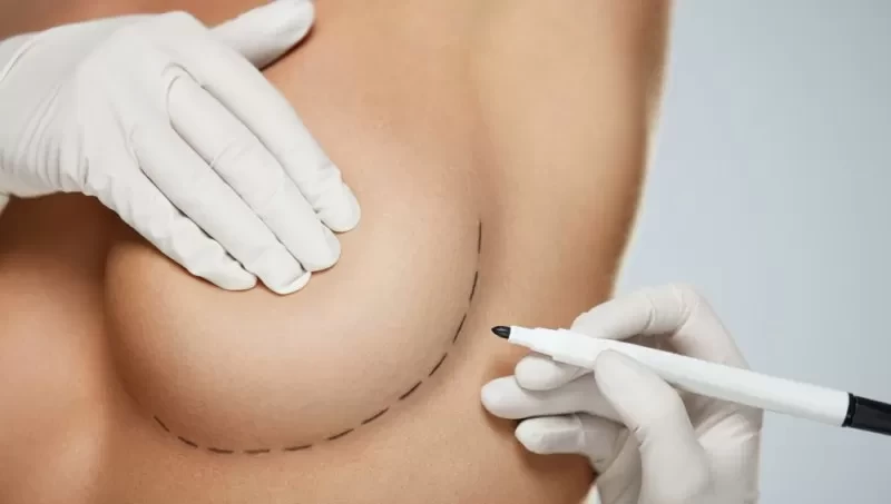 Breast Augmentation Surgery In Turkey: Comprehensive Guide and Latest Trends