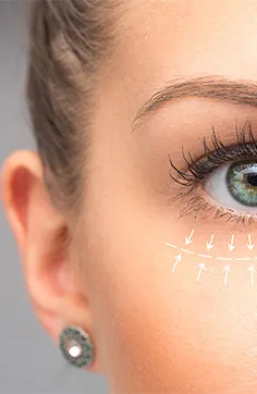 Why Should You Get Your Brow Surgery Lift In Turkey?