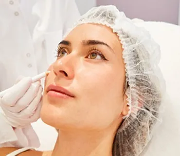 Dermal Filler Treatment 