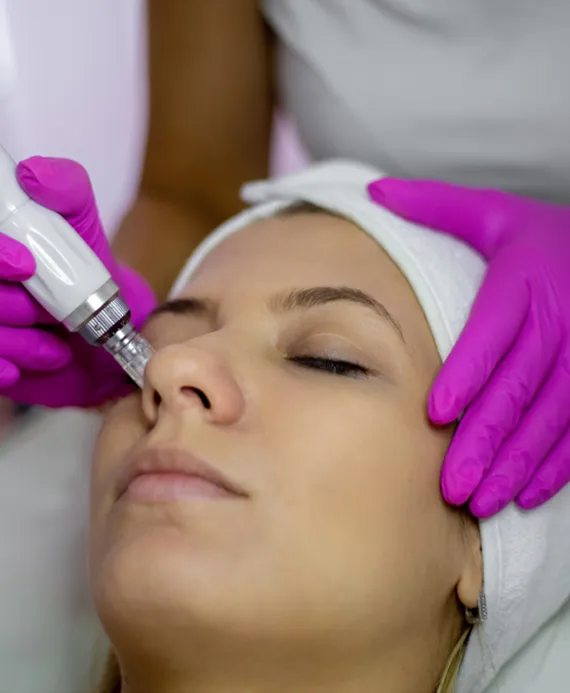 Dermapen Treatment