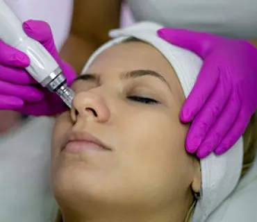 Dermapen Treatment