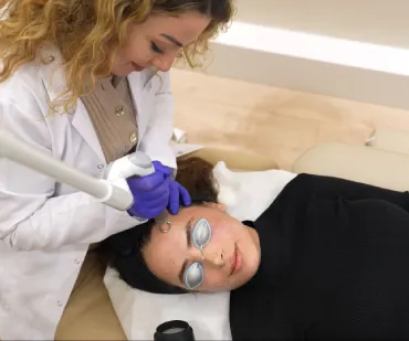 How Does Fractional Laser Work on Acne Scars?