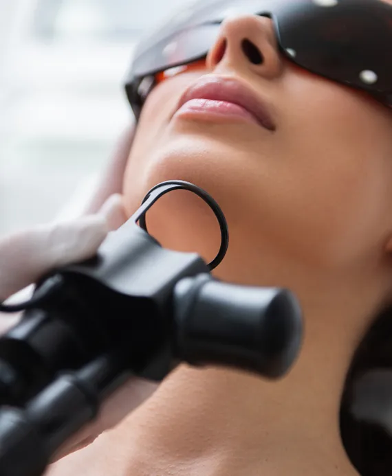 Fractional Laser Treatment