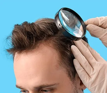 Fue Hair Transplant