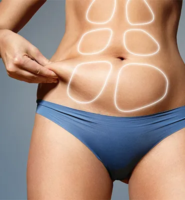 Liposuction