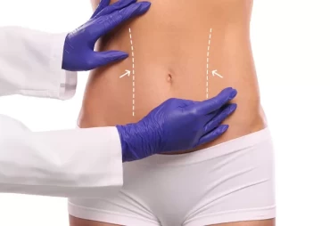 High-Definition Liposuction vs. Conventional Methods