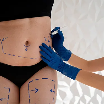 High Definition Liposuction