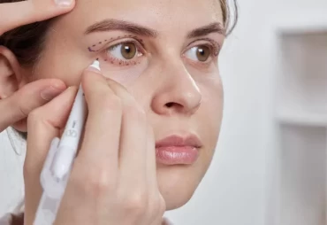 Preparing for Lower Blepharoplasty: Tips for a Smooth Surgery and Recovery