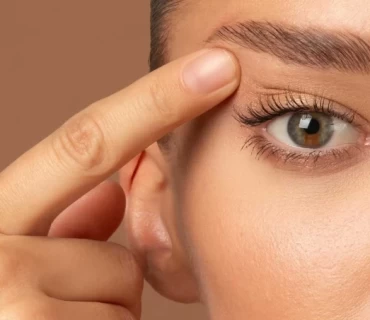 The Benefits of Upper Eyelid Surgery