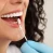 What Are The Qualities Of Poorly Done Dental Veneers?