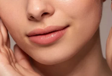 Which One To Choose Lip Lift vs. Lip Fillers