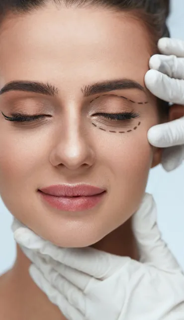 Blepharoplasty