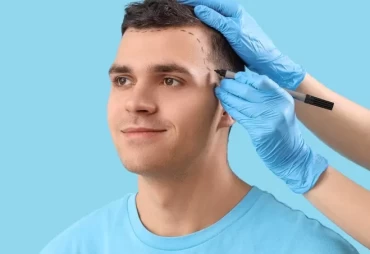 Why Turkey? Unveiling the Secrets Behind Successful Hair Transplants